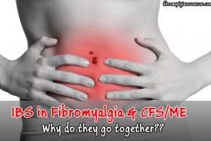 ibs fibromyalgia