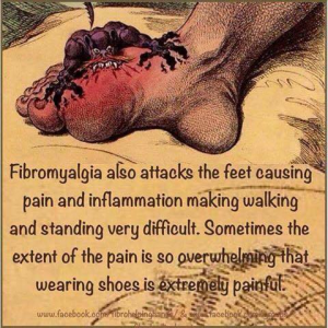 foot pain in fibromyalgia