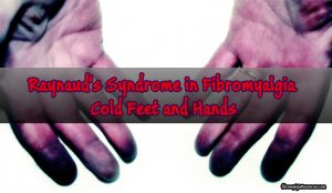 Raynaud's Syndrome in Fibromyalgia: Cold Feet and Hands