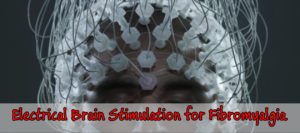 Electrical Brain Stimulation for Fibromyalgia