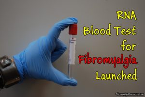 RNA Blood Test for Fibromyalgia Launched