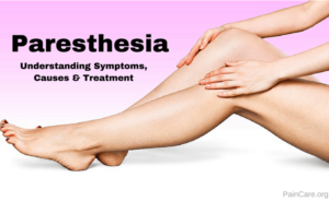 paresthesia fibromyalgia