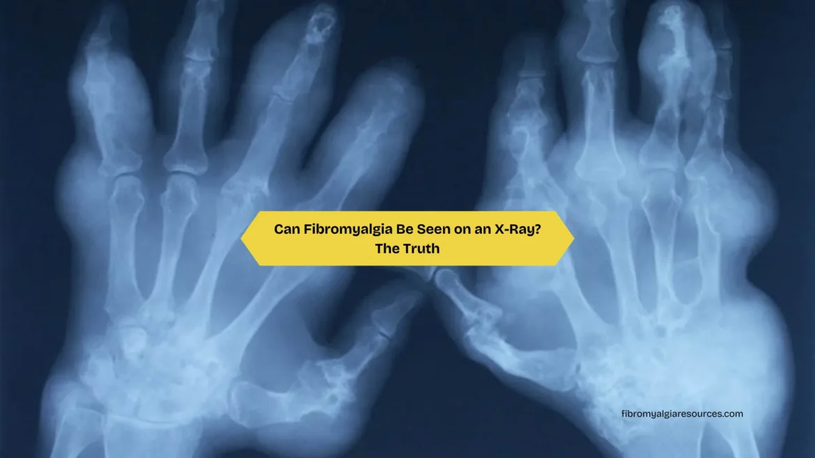 Can Fibromyalgia Be Seen on an X-Ray The Truth
