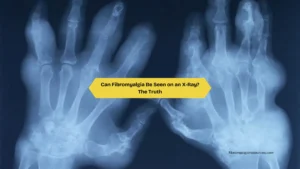 Can Fibromyalgia Be Seen on an X-Ray The Truth