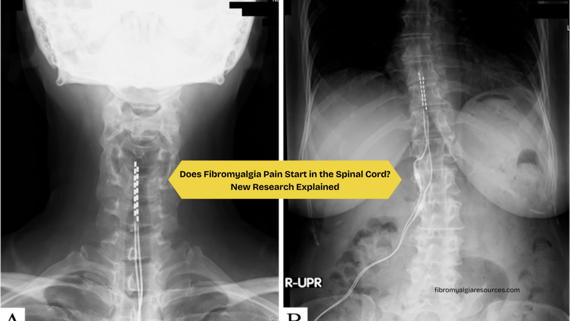 Does Fibromyalgia Pain Start in the Spinal Cord New Research Explained
