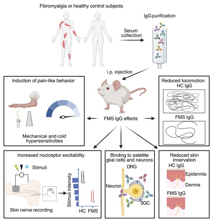 Fibromyalgia likely the result of autoimmune problems, Research.
